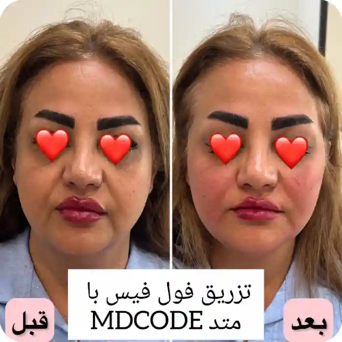 روش های تهاجمی جوانسازی پوست