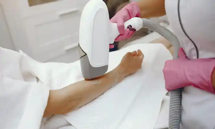 عوارض لیزر شاتی
