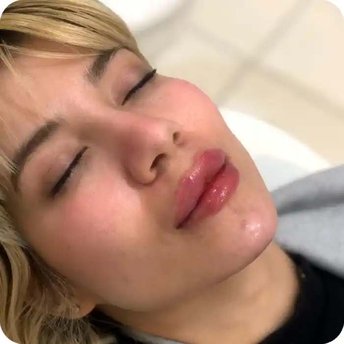 ژل لب عروسکی