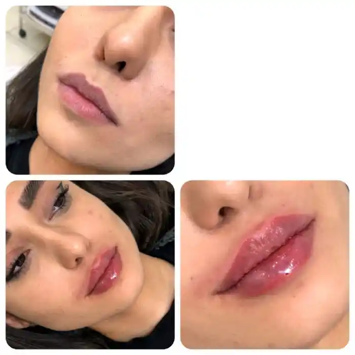 ژل لب غنچه ای