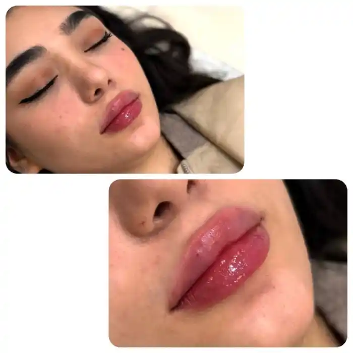 ژل لب قلبی