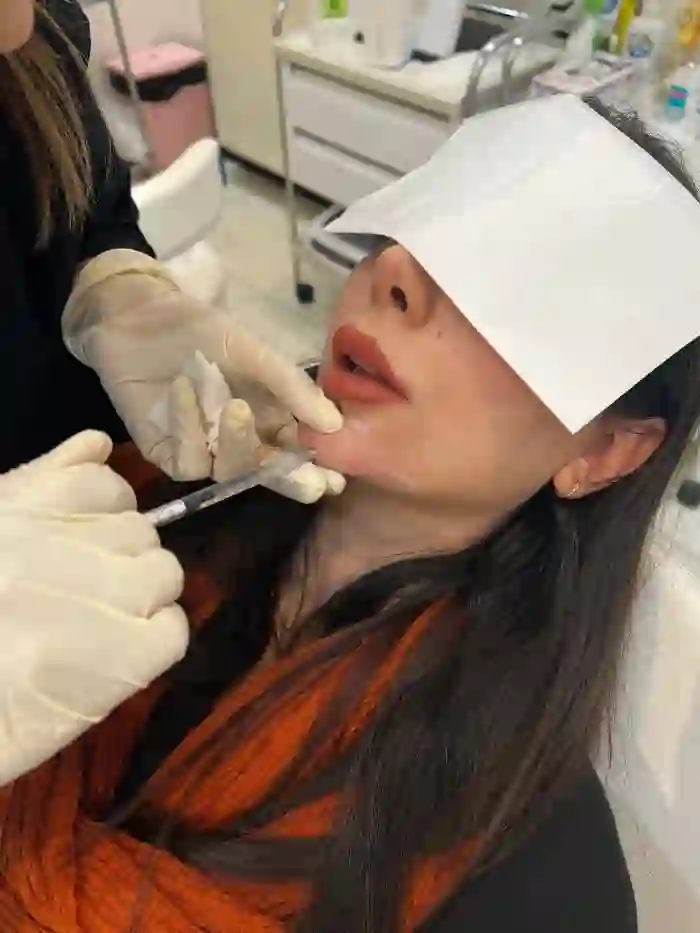 بهترین برند های تزریق ژل چانه کدام اند و هزینه هرکدام چقدر است