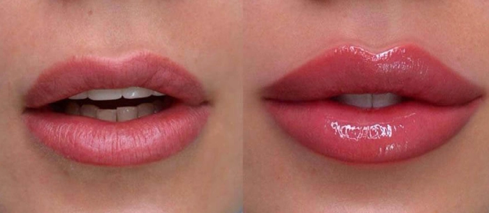 ژل لب روسی در کرج