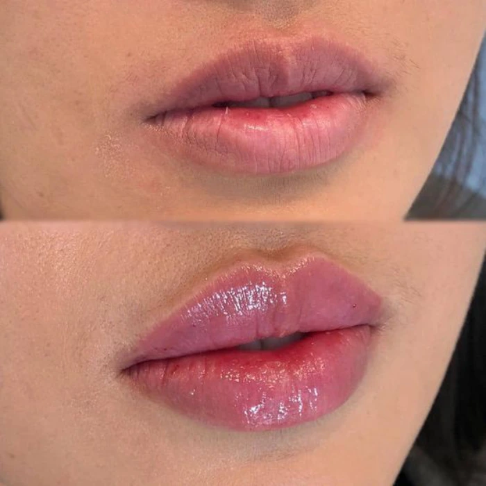 ژل لب روسی در کرج