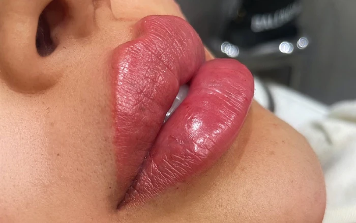 ژل لب روسی در کرج