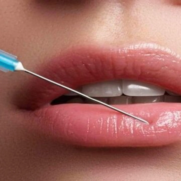 ژل لب روسی در کرج