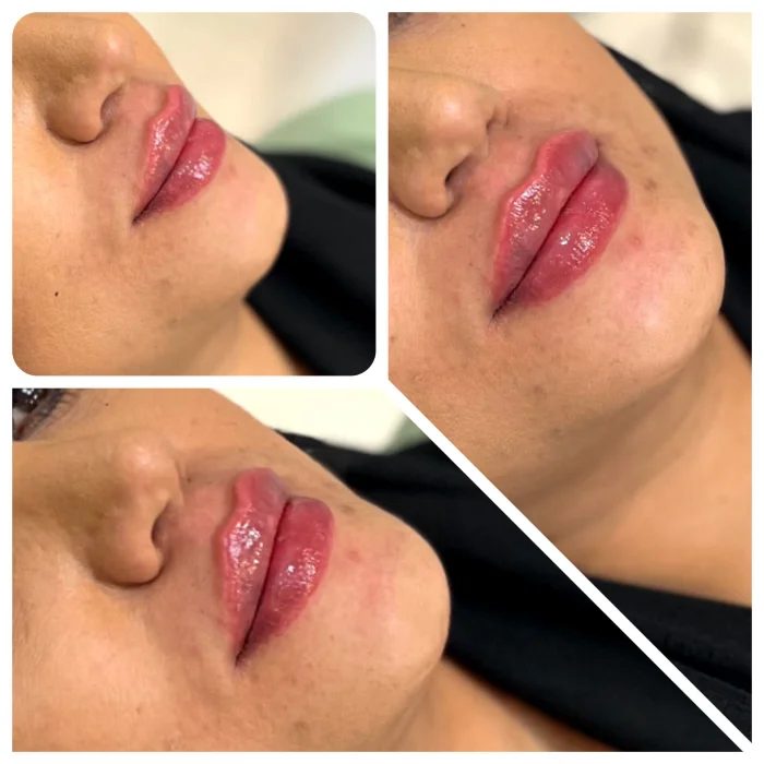 ژل لب برند نورامیس چه مزایایی دارد