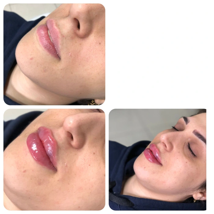 انواع مدل ژل لب با عکس طبیعی