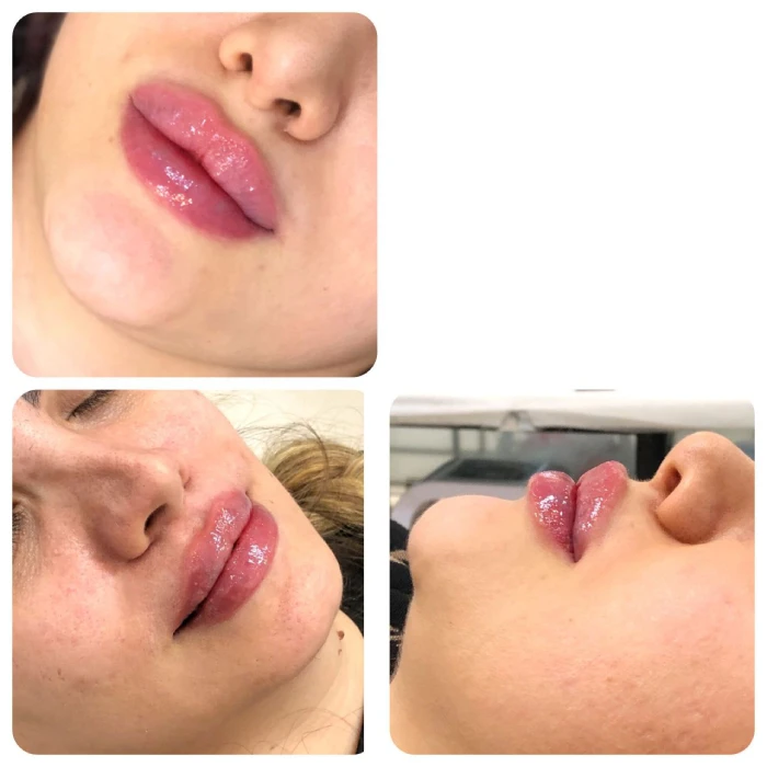 برندهای برتر ژل لب به ترتیب