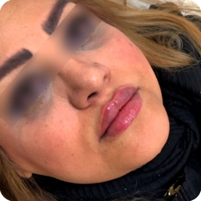 بهترین مارک ژل لب کره ای