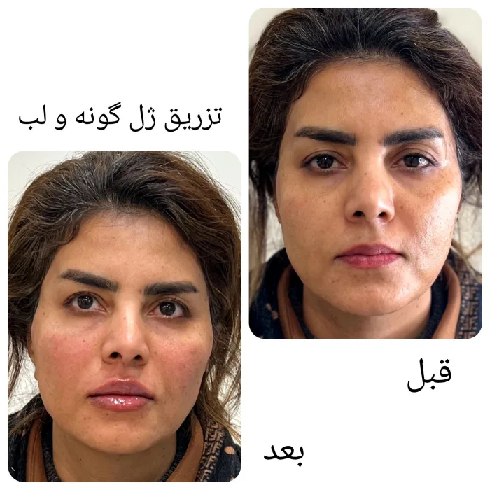 بهترین مرکز جوانسازی صورت در کرج