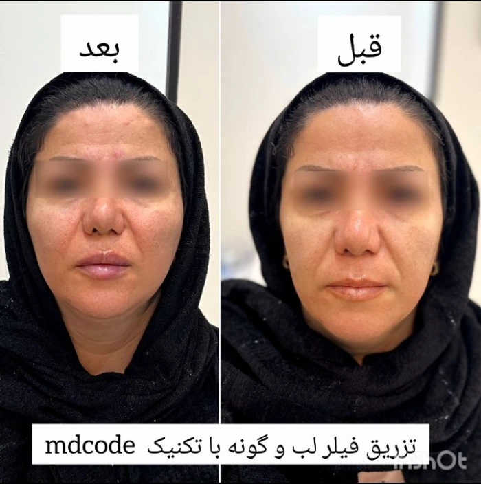 جوانسازی صورت در کرج