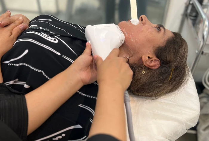 مزایای هایفوتراپی صورت