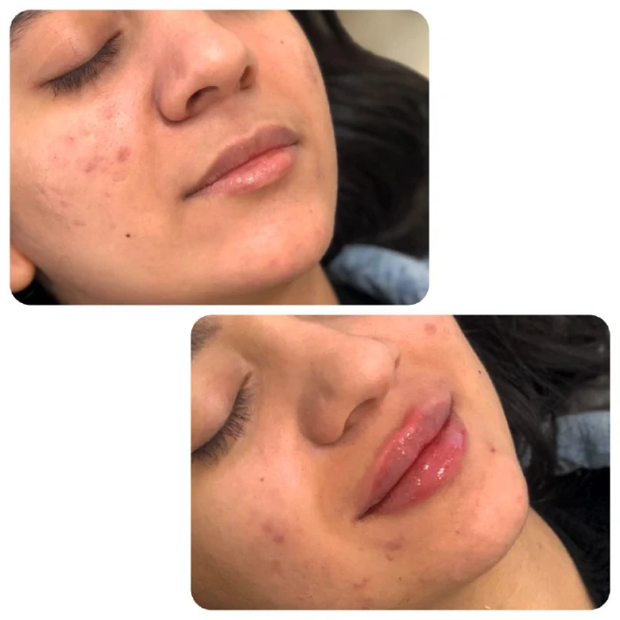 معرفی برندهای مطرح ژل لب