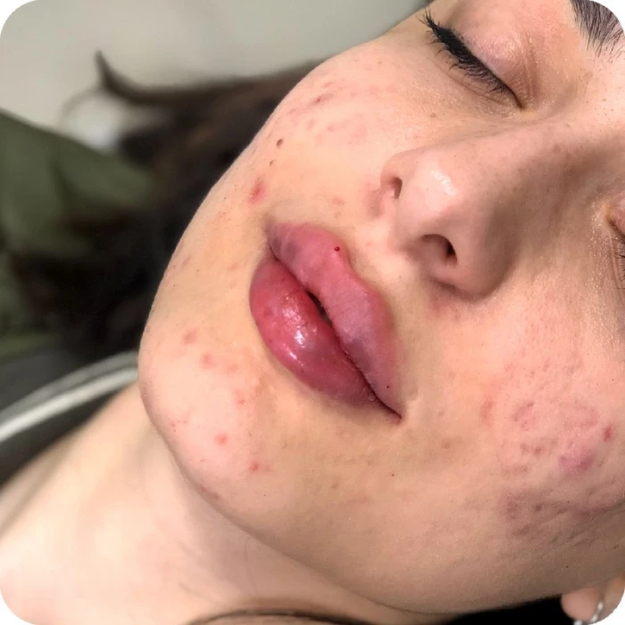 معرفی برندهای مطرح ژل لب