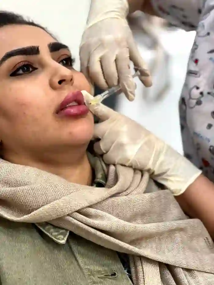 مناطق مناسب تزریق ژل نورامیس