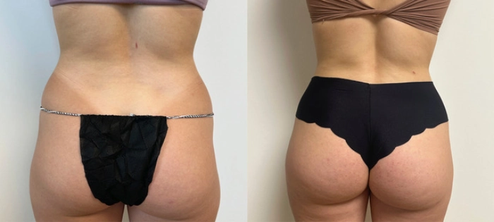 مراقبت‌های کلیدی پس از تزریق