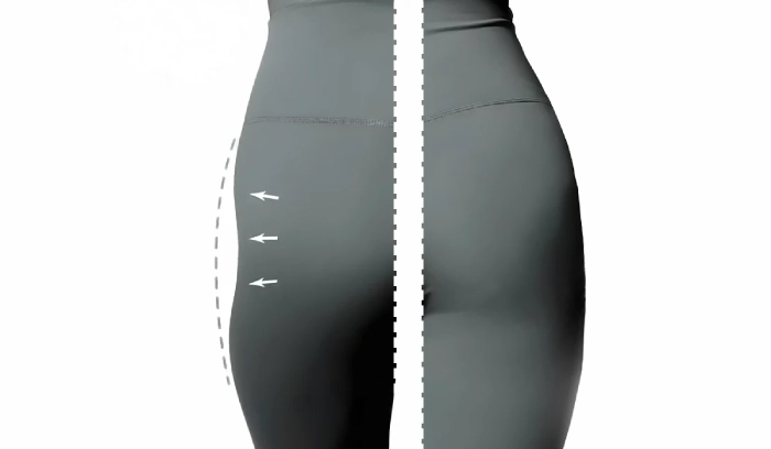 تفاوت تزریق ژل به هیپ دیپ در کرج با سایر روشها