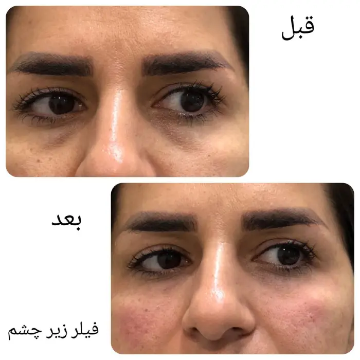 ویژگی های برجسته ژل نورامیس در مقایسه با سایر ژل ها