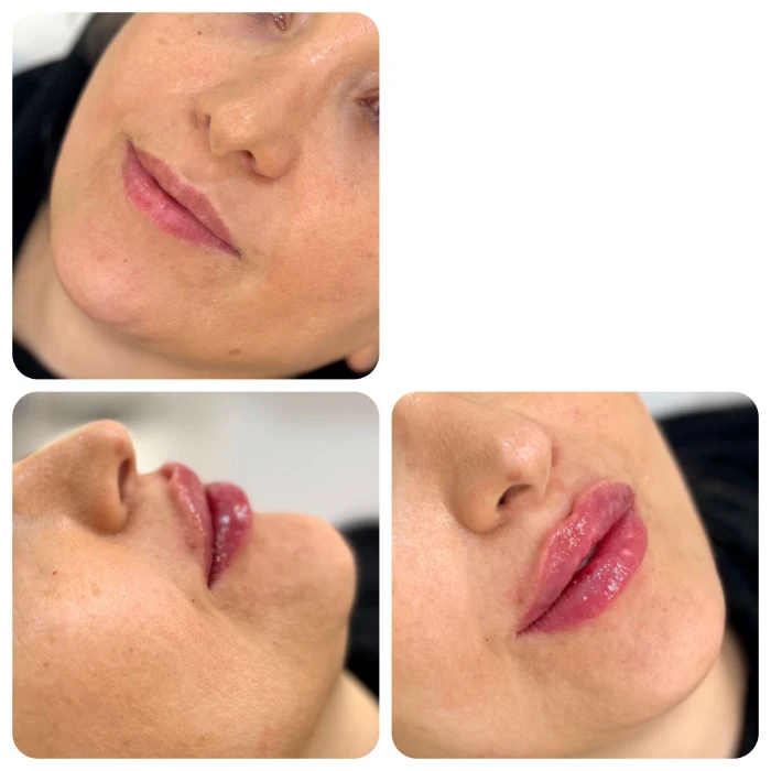 ویژگی‌های ژل لب طبیعی دخترانه