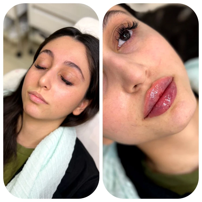 ژل لب طبیعی دخترانه