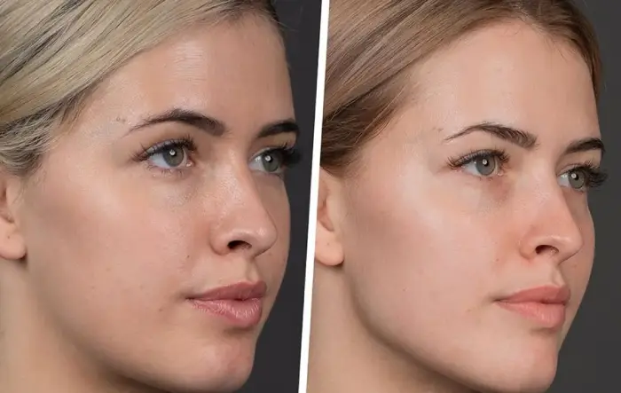 اهمیت کانتورینگ صورت گرد با ژل برای داشتن ظاهری متقارن