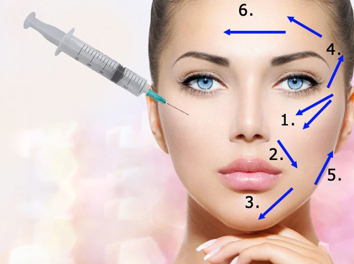 نکات مهم قبل از تزریق ژل