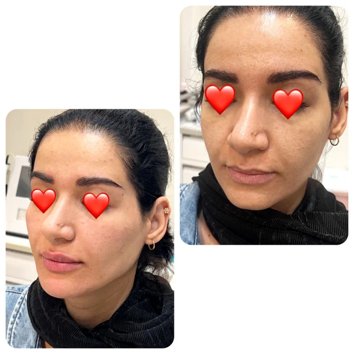 مراحل کانتورینگ صورت