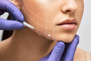 فرم دهی صورت با ژل