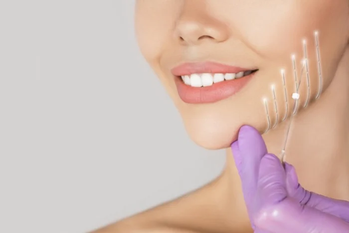 عوارض احتمالی زاویه سازی صورت با نخ