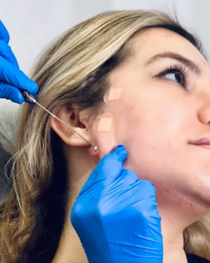 مراحل زاویه سازی صورت با نخ به چه صورت است؟