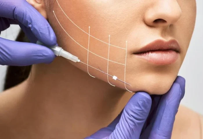 مزایا زاویه سازی صورت با نخ