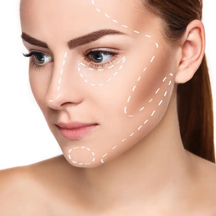 نقاط مهم تزریق برای مادلینگ صورت کشیده با تزریق ژل