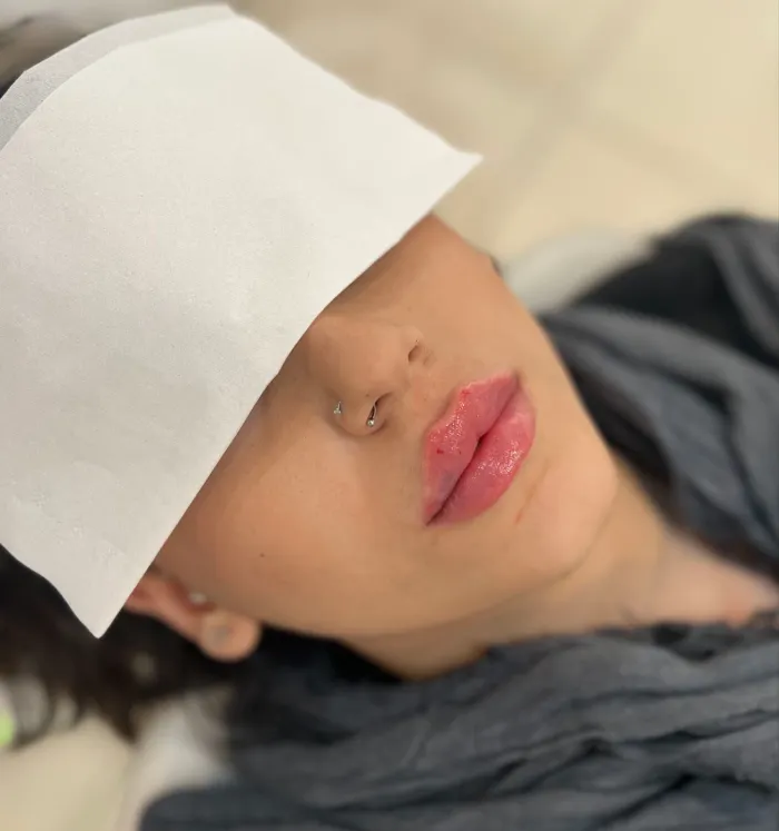 ژل اینوسنس بهتره یا نورامیس ، مزایا و معایب ژل اینوسنس