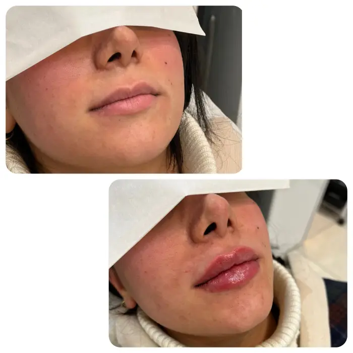 ژل اینوسنس بهتره یا نورامیس، معرفی ژل نورامیس