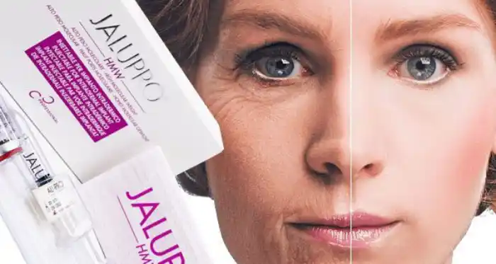 عوارض مزوژل جالپرو شایع و احتمالی