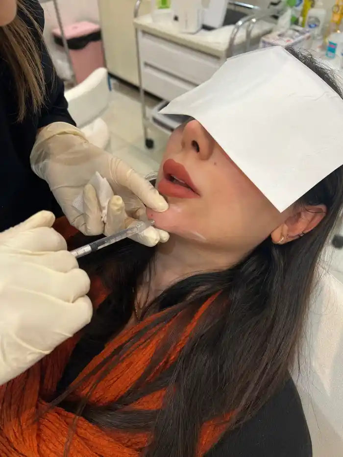 ژل چانه تیز