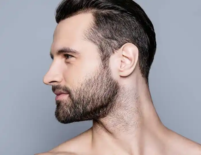 ماندگاری تزریق ژل چانه مردان چقدر است؟