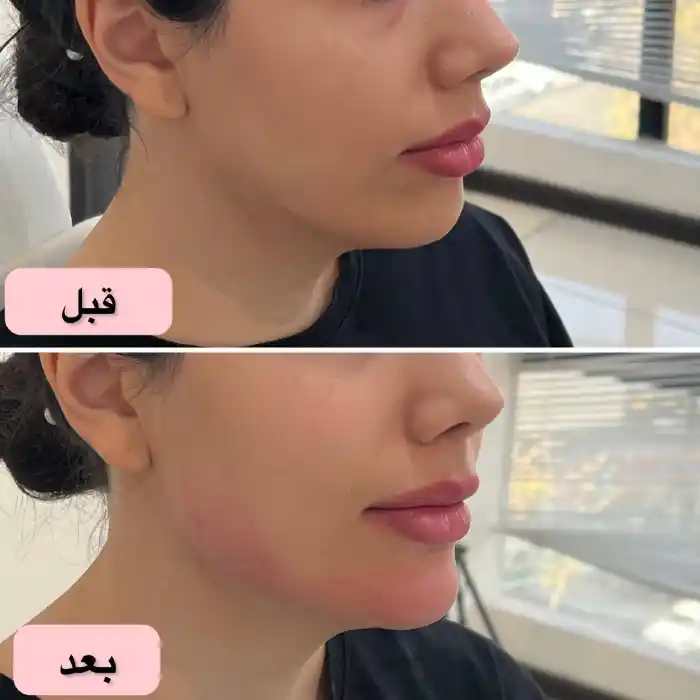 مزایای اصلی مادلینگ صورت نسبت به سایر روشها چیست؟