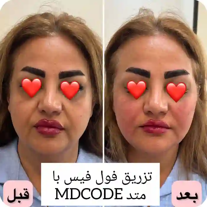 نگهداری صحیح برای ماندگاری مادلینگ صورت بیشتر