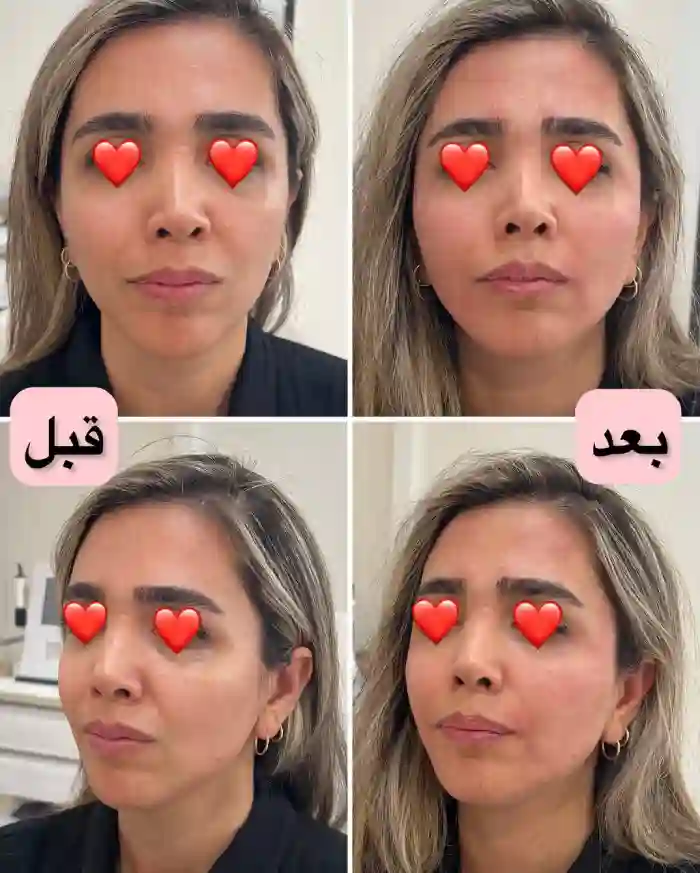 هزینه انجام مادلینگ صورت چقدر است؟