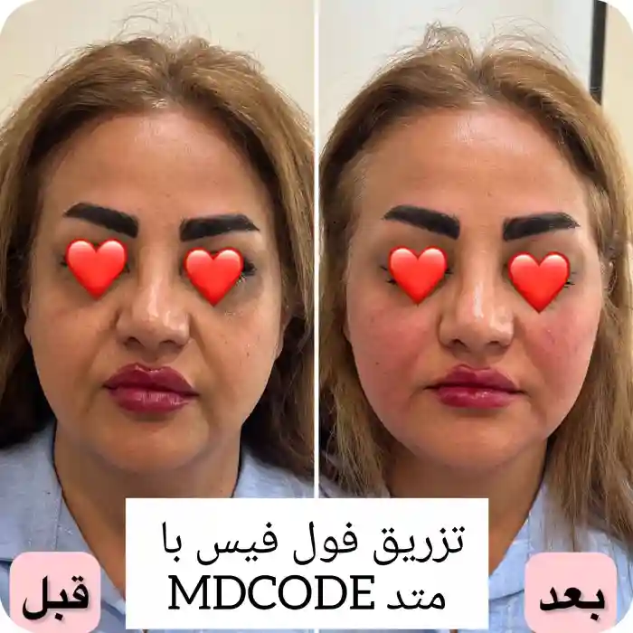 آیا گلوله شدن ژل گونه خطرناک است؟