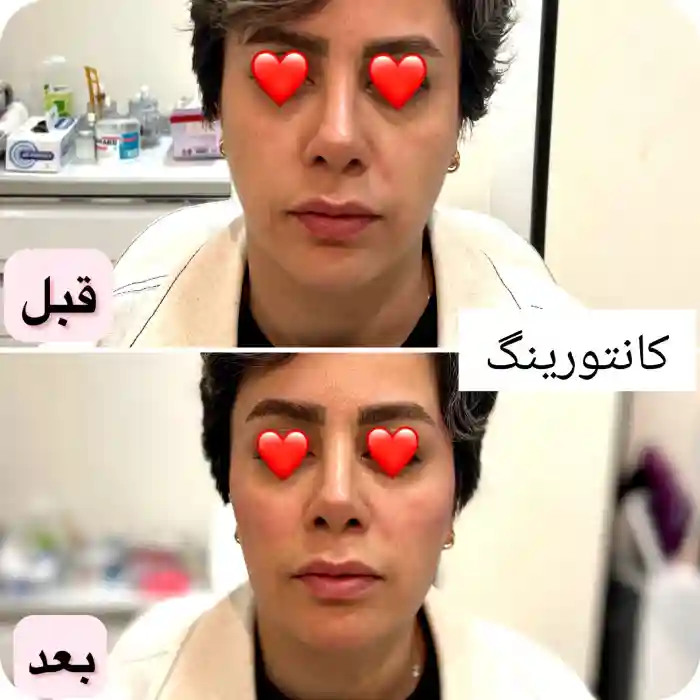 کات گونه با ژل روشی عالی برای زاویه سازی و برجسته سازی گونه