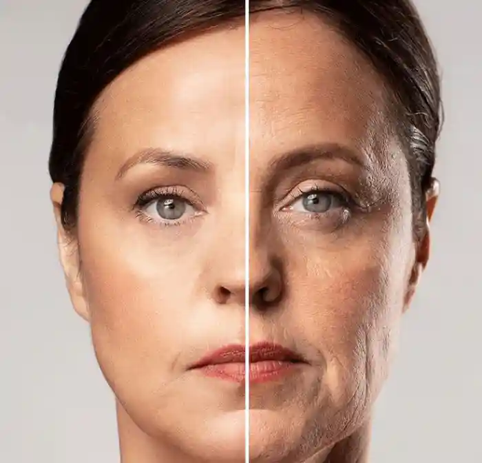 کاندیدهای مناسب تزریق مزوژل چه کسانی هستند؟