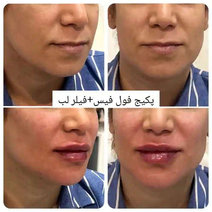 نتیجه گیری قیمت پکیج مادلینگ صورت